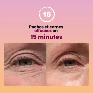 Alternative view of ÉCUME COLLAGEN – PATCHS ANTI-CERNES *1 PAIRE  – Effet instantané